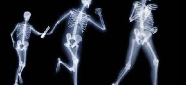 ¿Cómo prevenir el deterioro de nuestros huesos y evitar sus consecuencias?
